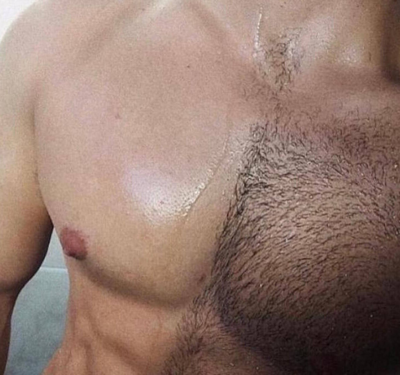 Hair Removal Permanent Solutions